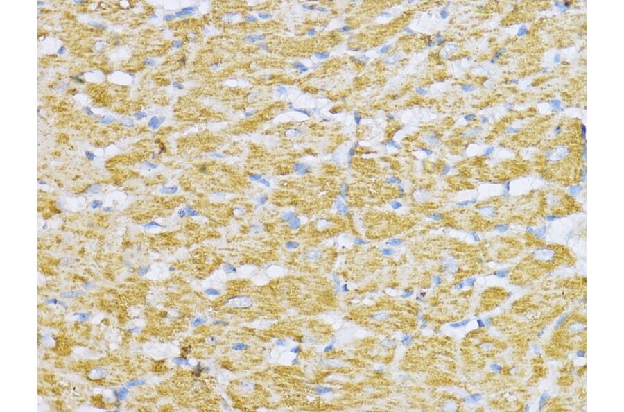 Immunohistochemistry - Anti-Aconitase 2 Antibody (A14448) - Antibodies.com