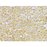 Immunohistochemistry - Anti-Aconitase 2 Antibody (A14448) - Antibodies.com