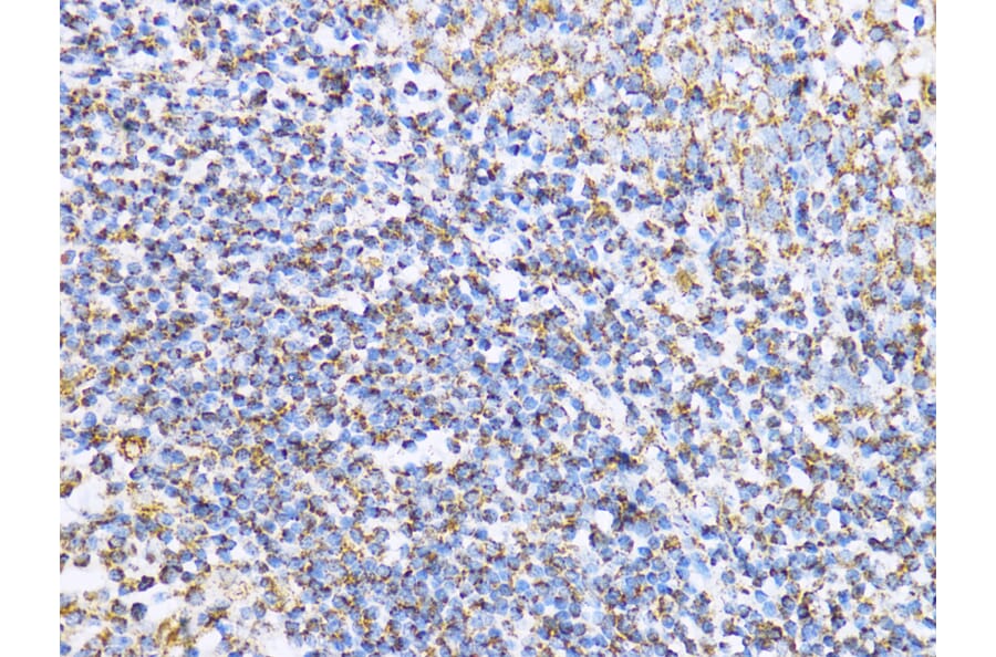 Immunohistochemistry - Anti-Aconitase 2 Antibody (A14448) - Antibodies.com