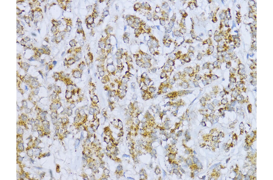 Immunohistochemistry - Anti-Aconitase 2 Antibody (A14448) - Antibodies.com