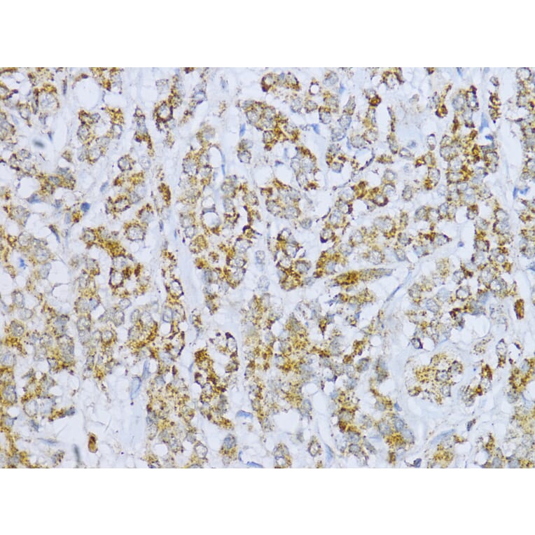 Immunohistochemistry - Anti-Aconitase 2 Antibody (A14448) - Antibodies.com