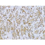 Immunohistochemistry - Anti-Aconitase 2 Antibody (A14448) - Antibodies.com