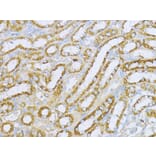 Immunohistochemistry - Anti-Aconitase 2 Antibody (A14448) - Antibodies.com