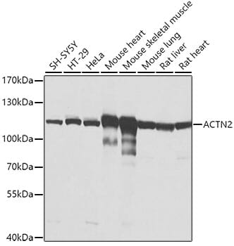 Anti-Sarcomeric Alpha Actinin Antibody