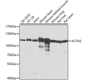 Western Blot - Anti-Sarcomeric Alpha Actinin Antibody (A14449) - Antibodies.com