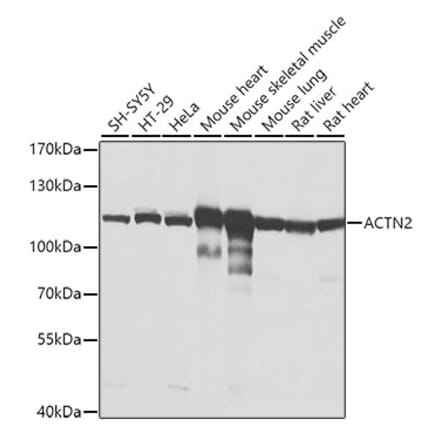 Western Blot - Anti-Sarcomeric Alpha Actinin Antibody (A14449) - Antibodies.com