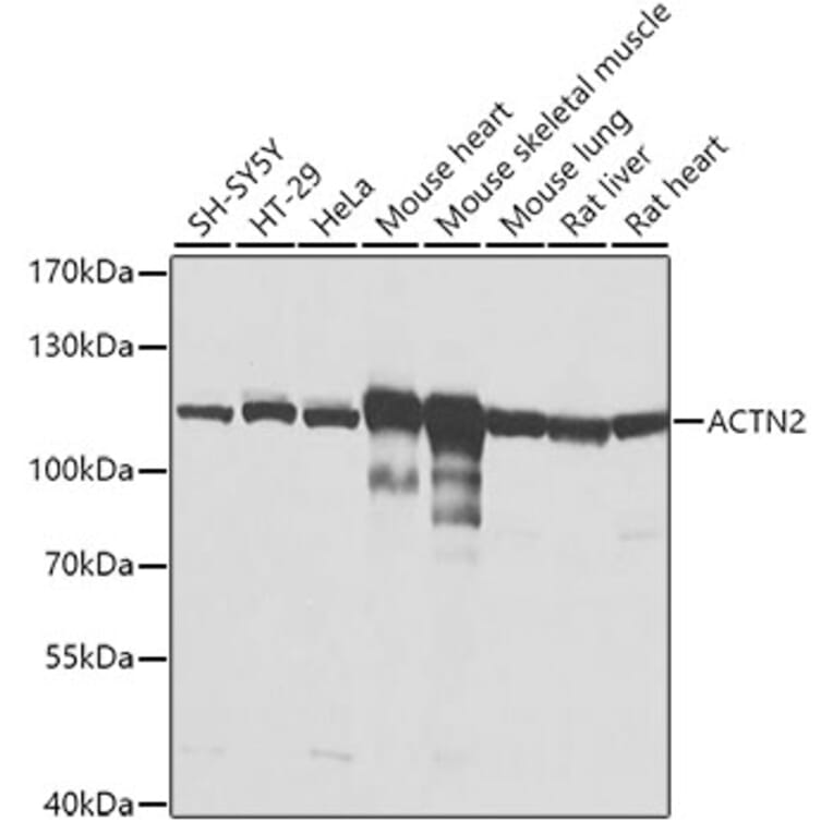 Western Blot - Anti-Sarcomeric Alpha Actinin Antibody (A14449) - Antibodies.com