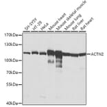 Western Blot - Anti-Sarcomeric Alpha Actinin Antibody (A14449) - Antibodies.com