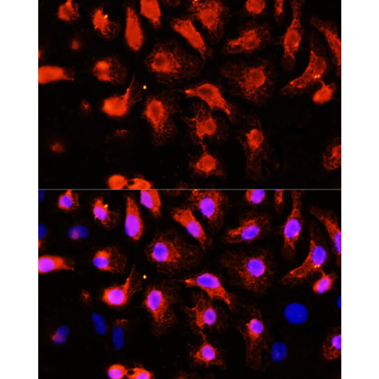 Immunofluorescence - Anti-Sarcomeric Alpha Actinin Antibody (A14449) - Antibodies.com