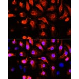 Immunofluorescence - Anti-Sarcomeric Alpha Actinin Antibody (A14449) - Antibodies.com