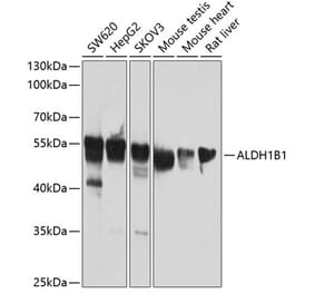 Western Blot - Anti-ALDH1B1 Antibody (A14451) - Antibodies.com