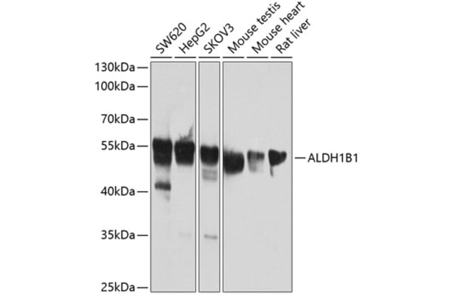Western Blot - Anti-ALDH1B1 Antibody (A14451) - Antibodies.com