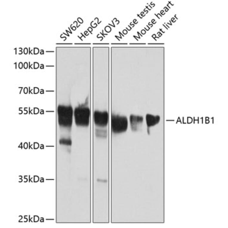 Western Blot - Anti-ALDH1B1 Antibody (A14451) - Antibodies.com