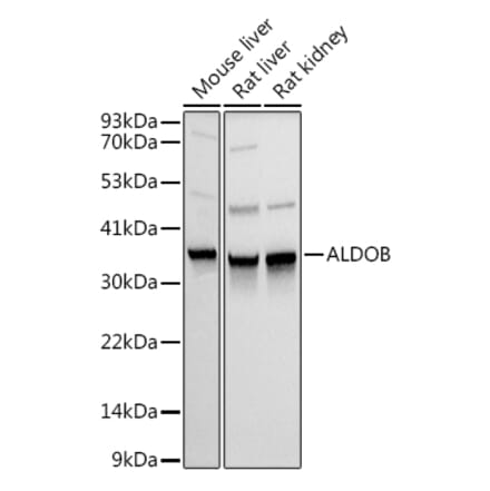 Western Blot - Anti-Aldolase B Antibody (A14452) - Antibodies.com