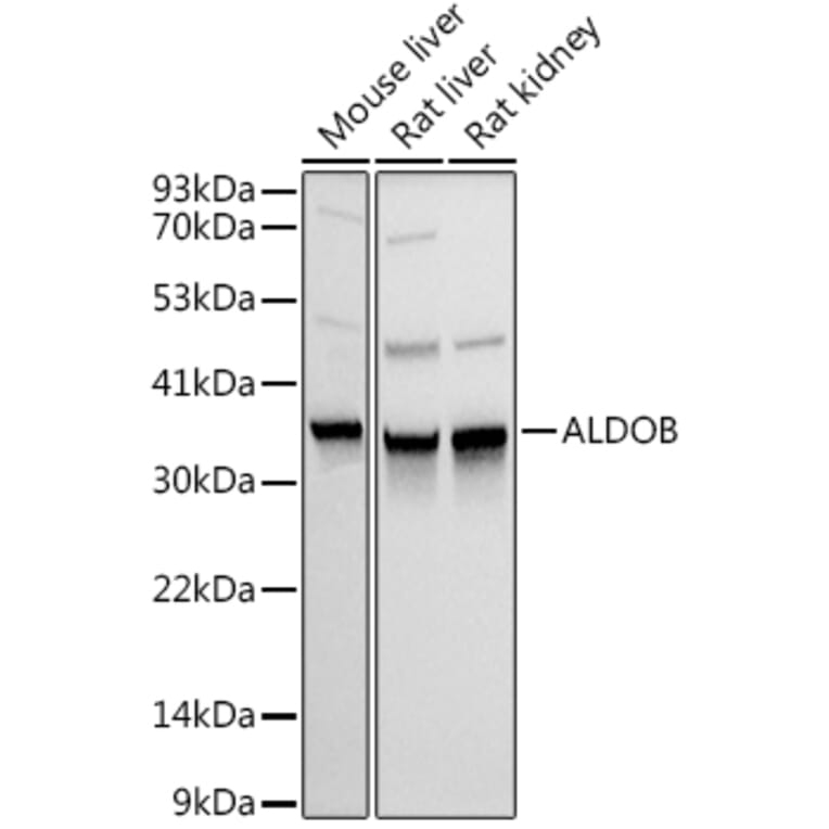 Western Blot - Anti-Aldolase B Antibody (A14452) - Antibodies.com