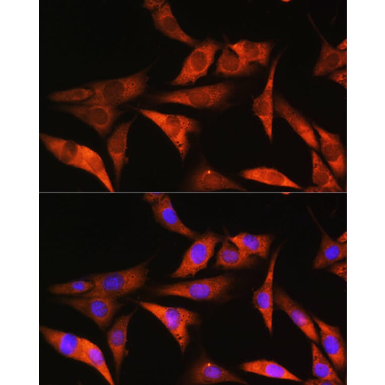 Immunofluorescence - Anti-Aldolase B Antibody (A14452) - Antibodies.com
