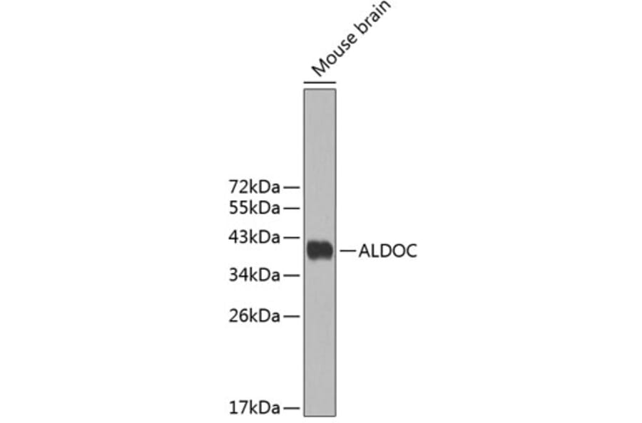 Western Blot - Anti-ALDOC Antibody (A3729) - Antibodies.com