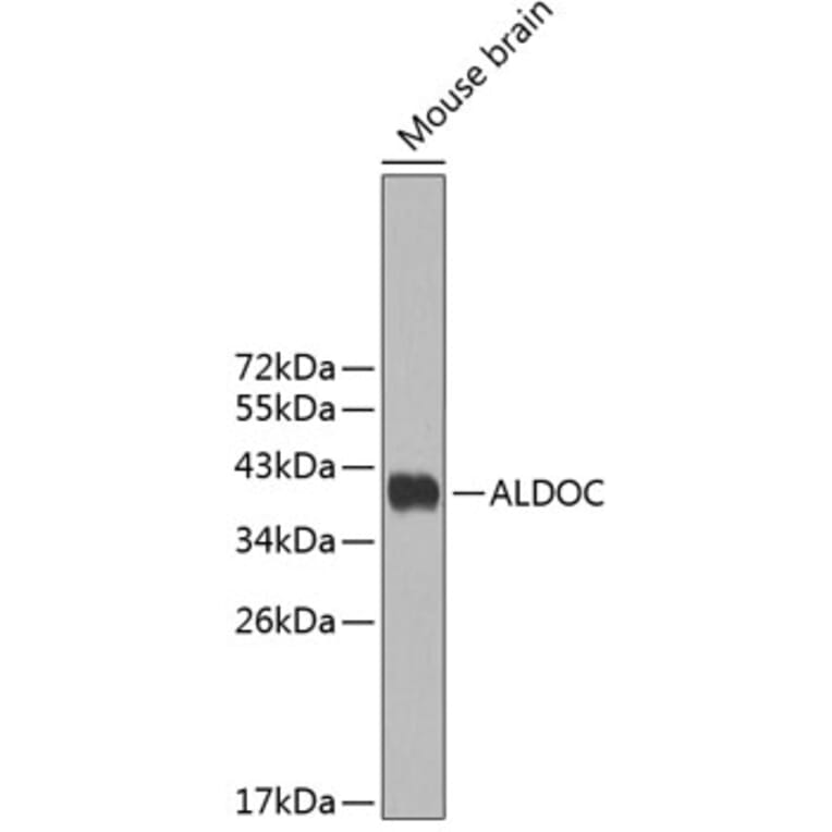 Western Blot - Anti-ALDOC Antibody (A3729) - Antibodies.com