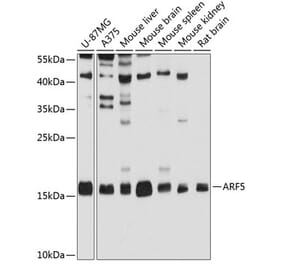 Western Blot - Anti-ARF5 Antibody (A14454) - Antibodies.com