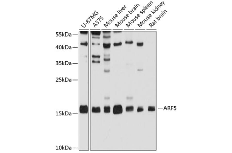 Western Blot - Anti-ARF5 Antibody (A14454) - Antibodies.com