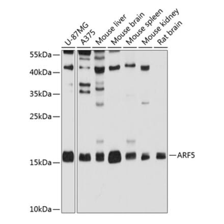 Western Blot - Anti-ARF5 Antibody (A14454) - Antibodies.com