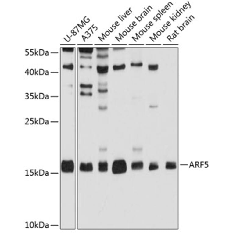 Western Blot - Anti-ARF5 Antibody (A14454) - Antibodies.com