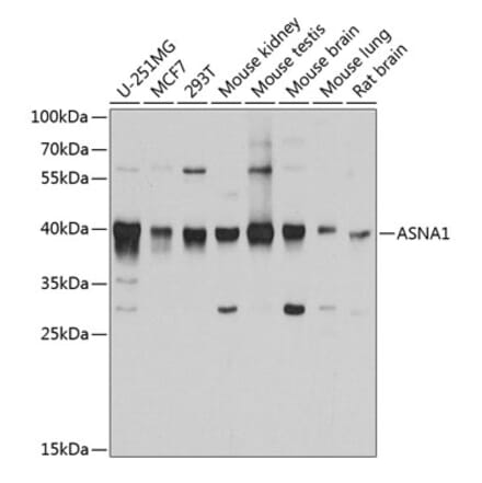 Western Blot - Anti-TRC40 Antibody (A14455) - Antibodies.com