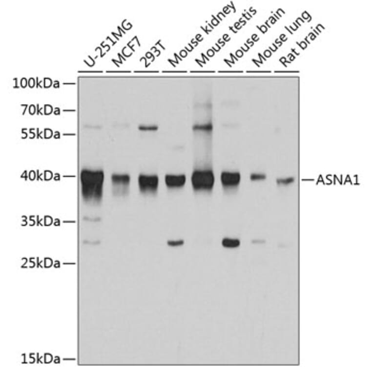 Western Blot - Anti-TRC40 Antibody (A14455) - Antibodies.com