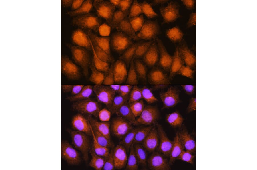 Immunofluorescence - Anti-TRC40 Antibody (A14455) - Antibodies.com