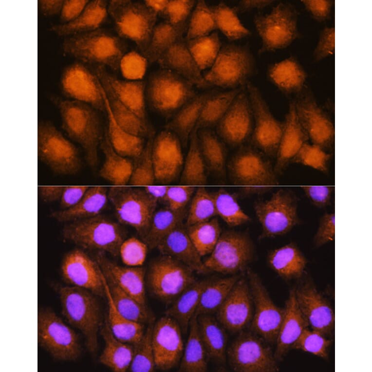 Immunofluorescence - Anti-TRC40 Antibody (A14455) - Antibodies.com