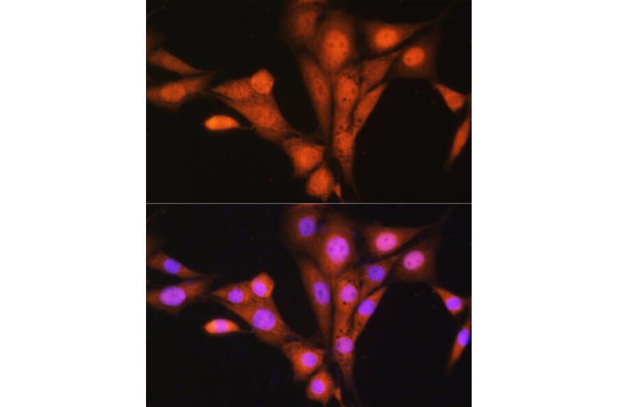 Immunofluorescence - Anti-TRC40 Antibody (A14455) - Antibodies.com