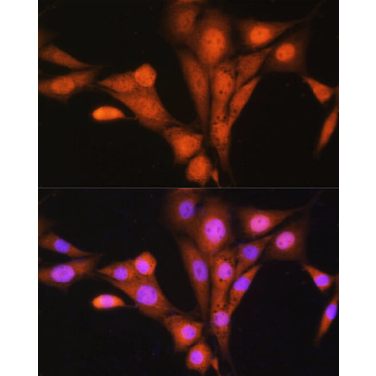 Immunofluorescence - Anti-TRC40 Antibody (A14455) - Antibodies.com