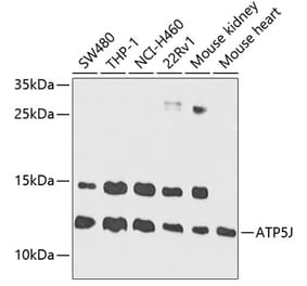 Western Blot - Anti-ATP5J Antibody (A14457) - Antibodies.com