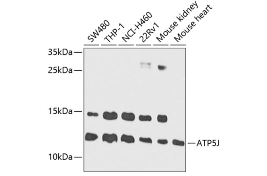 Western Blot - Anti-ATP5J Antibody (A14457) - Antibodies.com