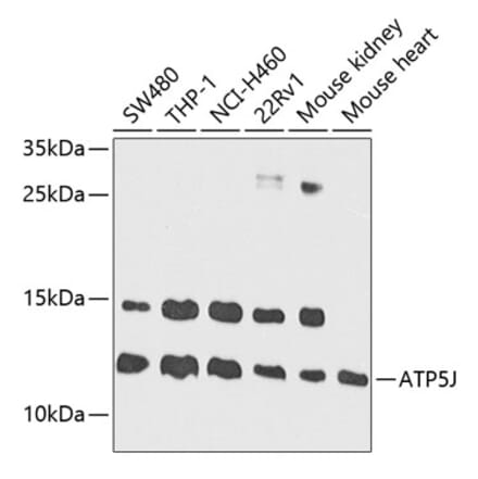 Western Blot - Anti-ATP5J Antibody (A14457) - Antibodies.com