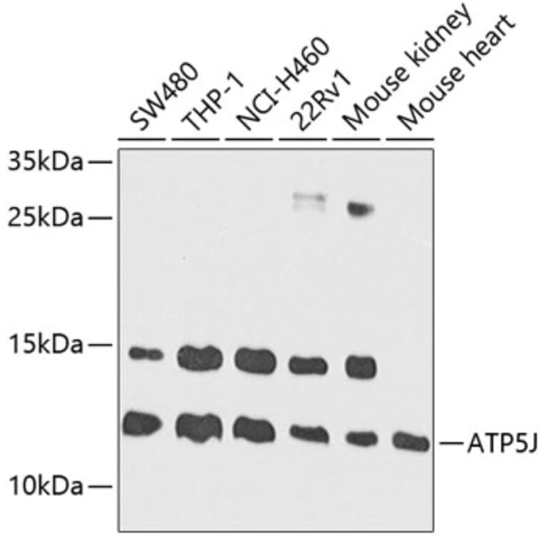 Western Blot - Anti-ATP5J Antibody (A14457) - Antibodies.com