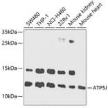 Western Blot - Anti-ATP5J Antibody (A14457) - Antibodies.com