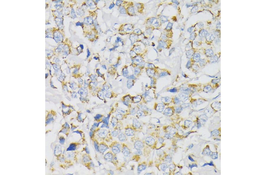 Immunohistochemistry - Anti-ATP5J Antibody (A14457) - Antibodies.com
