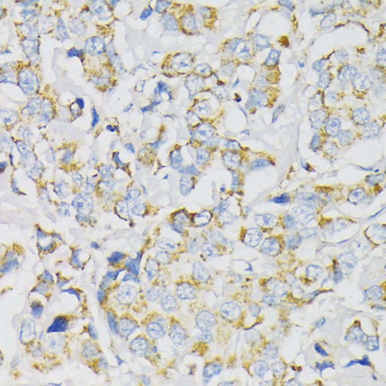 Immunohistochemistry - Anti-ATP5J Antibody (A14457) - Antibodies.com