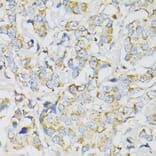 Immunohistochemistry - Anti-ATP5J Antibody (A14457) - Antibodies.com