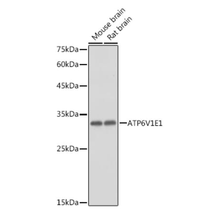 Western Blot - Anti-ATP6V1E1 Antibody (A14458) - Antibodies.com