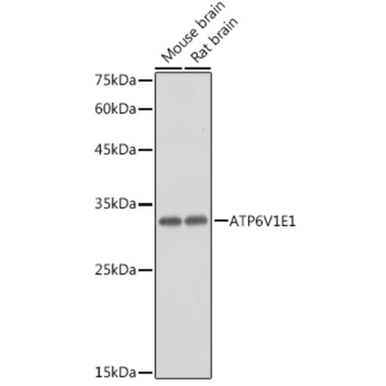 Western Blot - Anti-ATP6V1E1 Antibody (A14458) - Antibodies.com