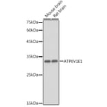 Western Blot - Anti-ATP6V1E1 Antibody (A14458) - Antibodies.com