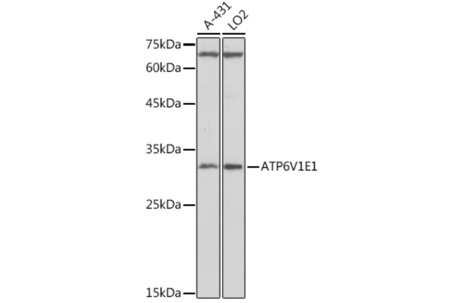 Western Blot - Anti-ATP6V1E1 Antibody (A14458) - Antibodies.com