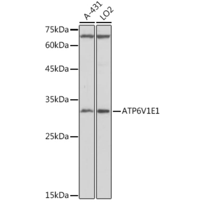 Western Blot - Anti-ATP6V1E1 Antibody (A14458) - Antibodies.com
