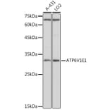 Western Blot - Anti-ATP6V1E1 Antibody (A14458) - Antibodies.com