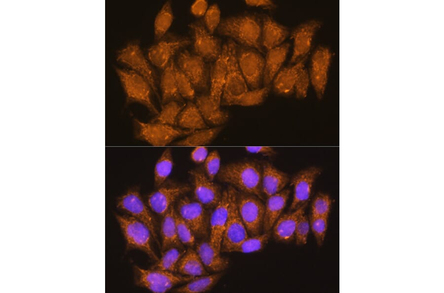Immunofluorescence - Anti-ATP6V1E1 Antibody (A14458) - Antibodies.com