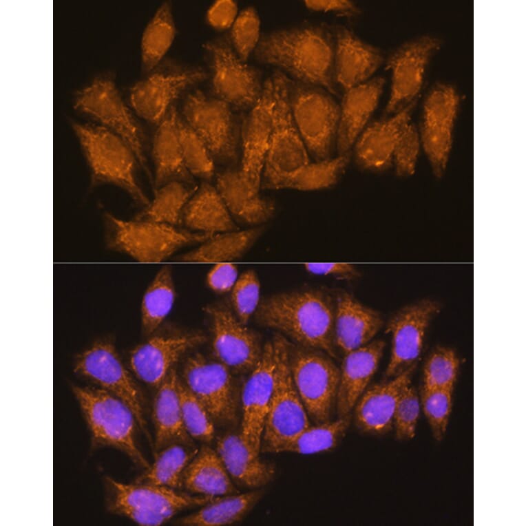 Immunofluorescence - Anti-ATP6V1E1 Antibody (A14458) - Antibodies.com