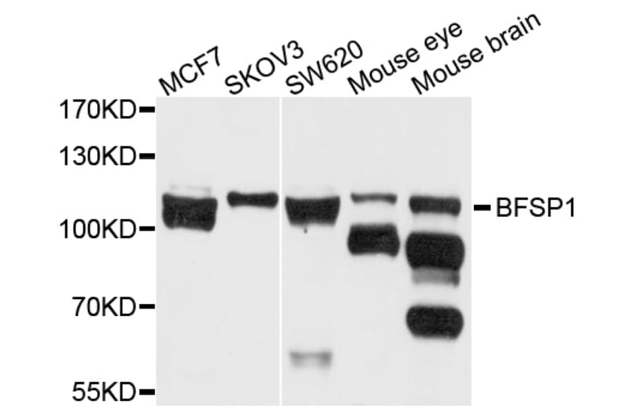 Western Blot - Anti-BFSP1 Antibody (A3764) - Antibodies.com