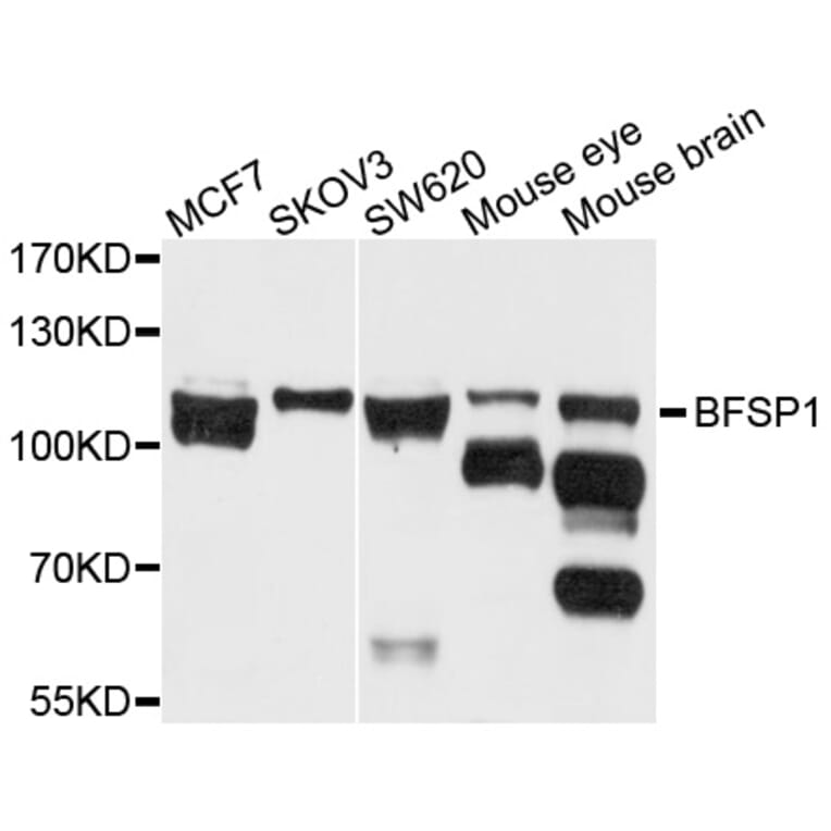 Western Blot - Anti-BFSP1 Antibody (A3764) - Antibodies.com